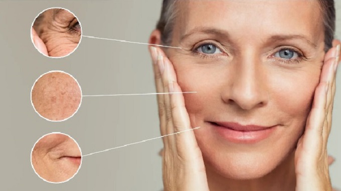 Da lão hóa là hiện tượng da mất đi độ đàn hồi, săn chắc, xuất hiện nếp nhăn, chảy xệ, nám, tàn nhang