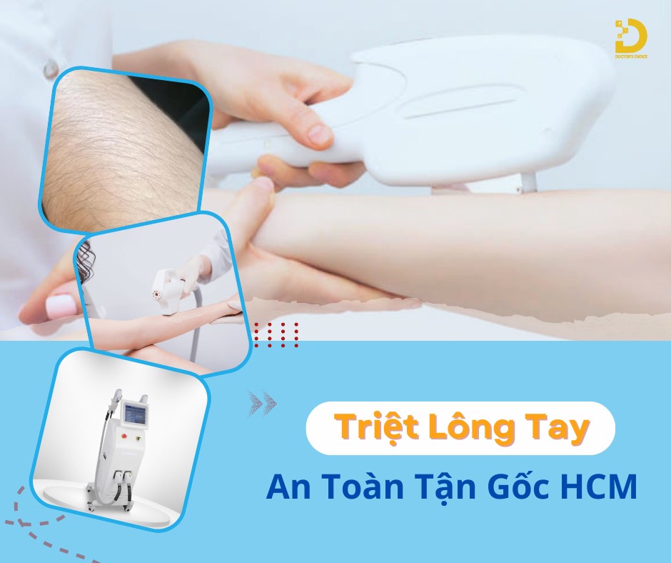 Doctor's Choice Clinic có dịch vụ triệt lông tận gốc an toàn hiệu quả