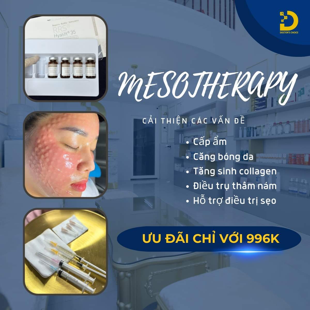 Điều trị thâm mụn bằng phương pháp Mesotherapy