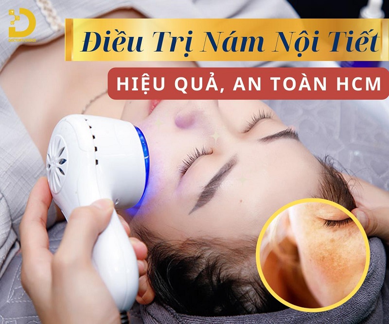 Dịch vụ điều trị nám nội tiết an toàn tại HCM