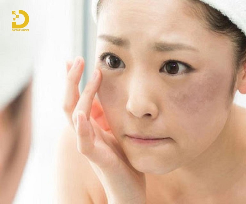 dieu tri nam noi tiet 2