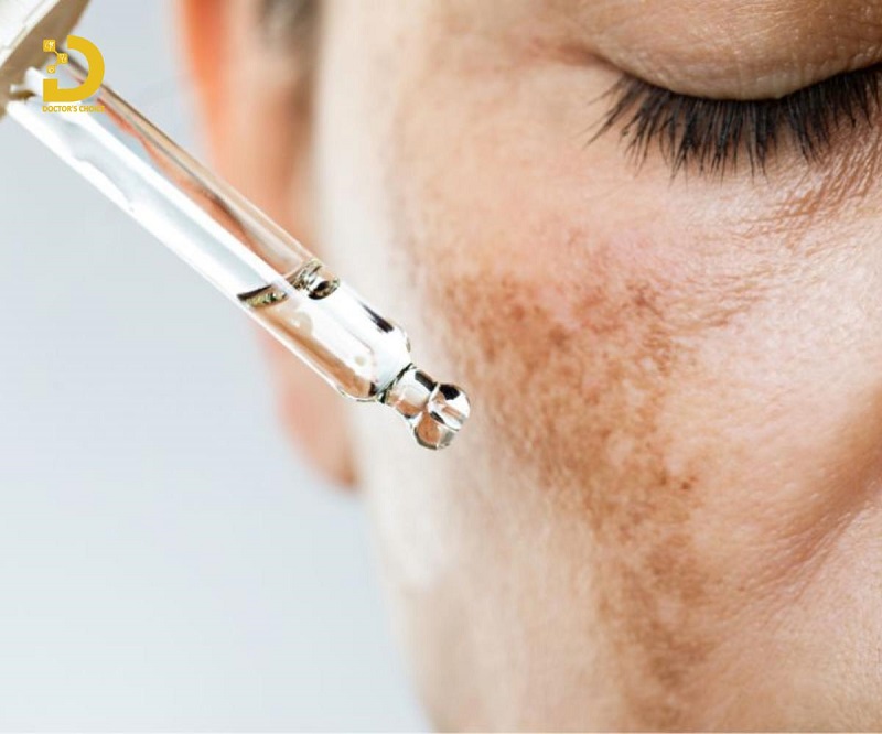 dieu tri nam noi tiet 4