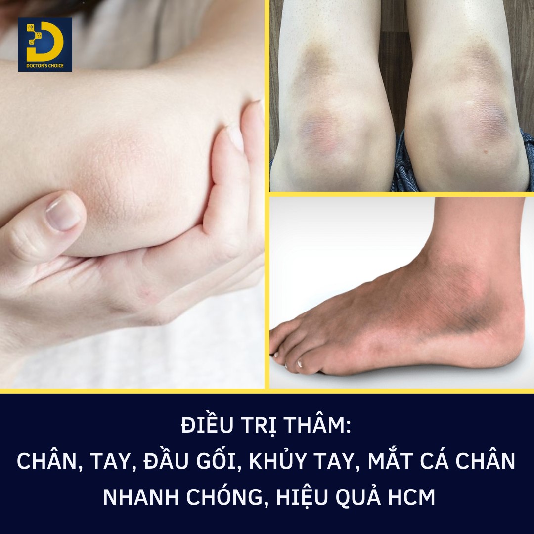 Doctor's Choice Clinic mang đến giải pháp điều trị thâm da toàn diện, nhanh chóng và an toàn