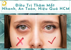 dieu tri tham mat hcm