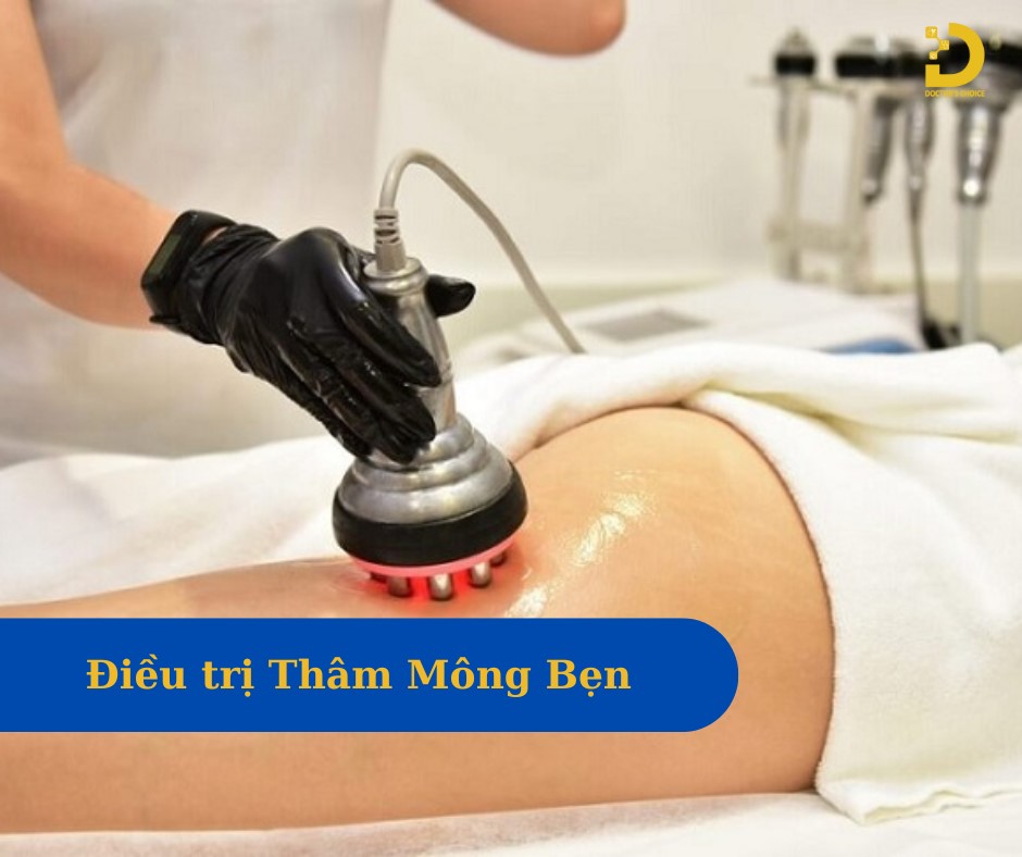 Những trường hợp thâm nặng, bạn nên tìm đến các cơ sở thẩm mỹ uy tín để được tư vấn và điều trị