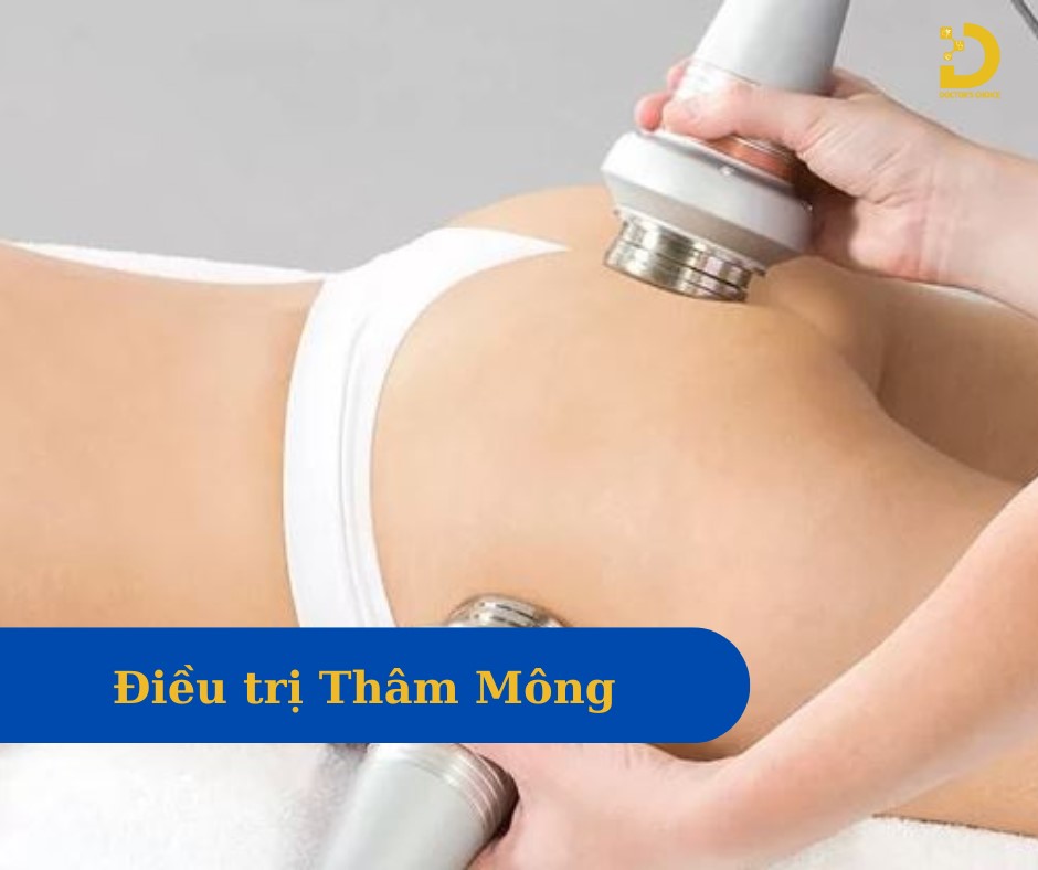 Hình ảnh điều trị thâm vùng kín