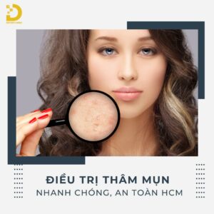 Doctor's Choice Clinic mang đến dịch vụ điều trị thâm mụn nhanh chóng, an toàn tại TP.HCM