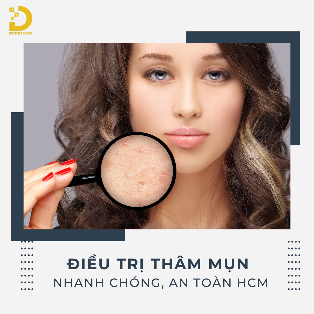 Doctor's Choice Clinic mang đến dịch vụ điều trị thâm mụn nhanh chóng, an toàn tại TP.HCM