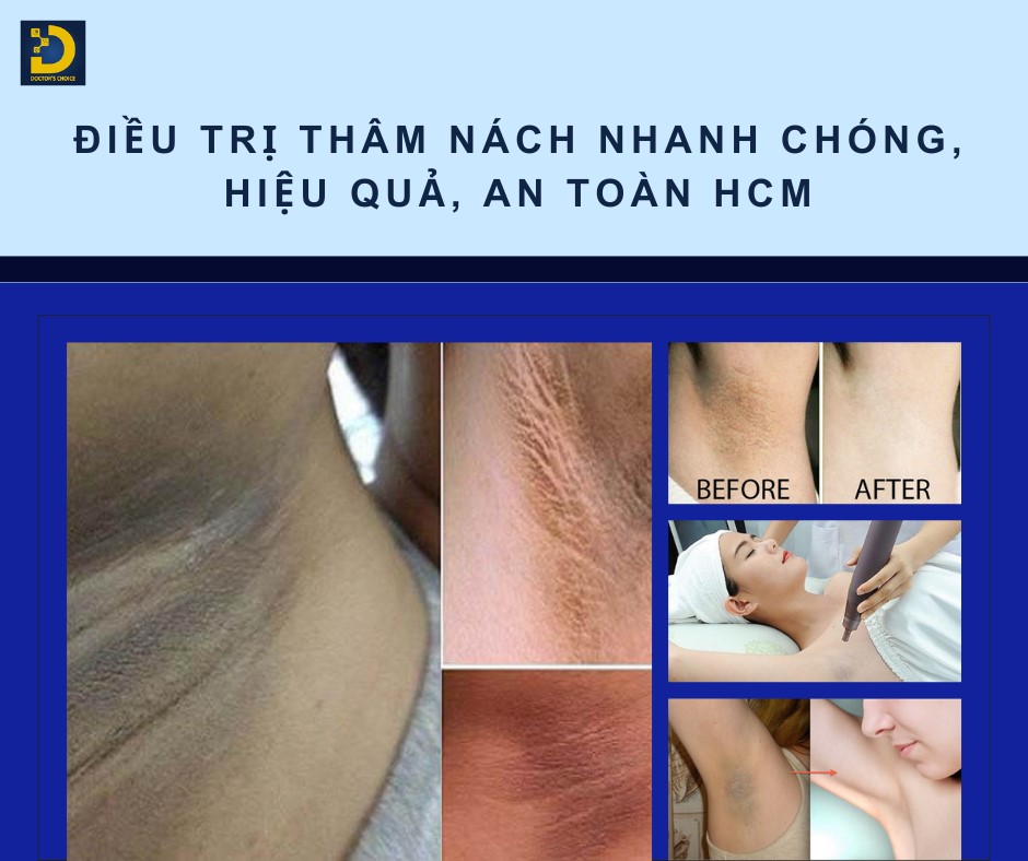 Điều trị thâm nách