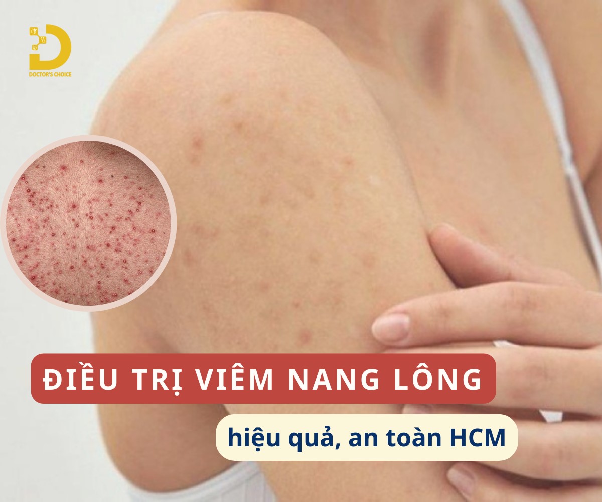 Dịch vụ điều trị viêm nang lông