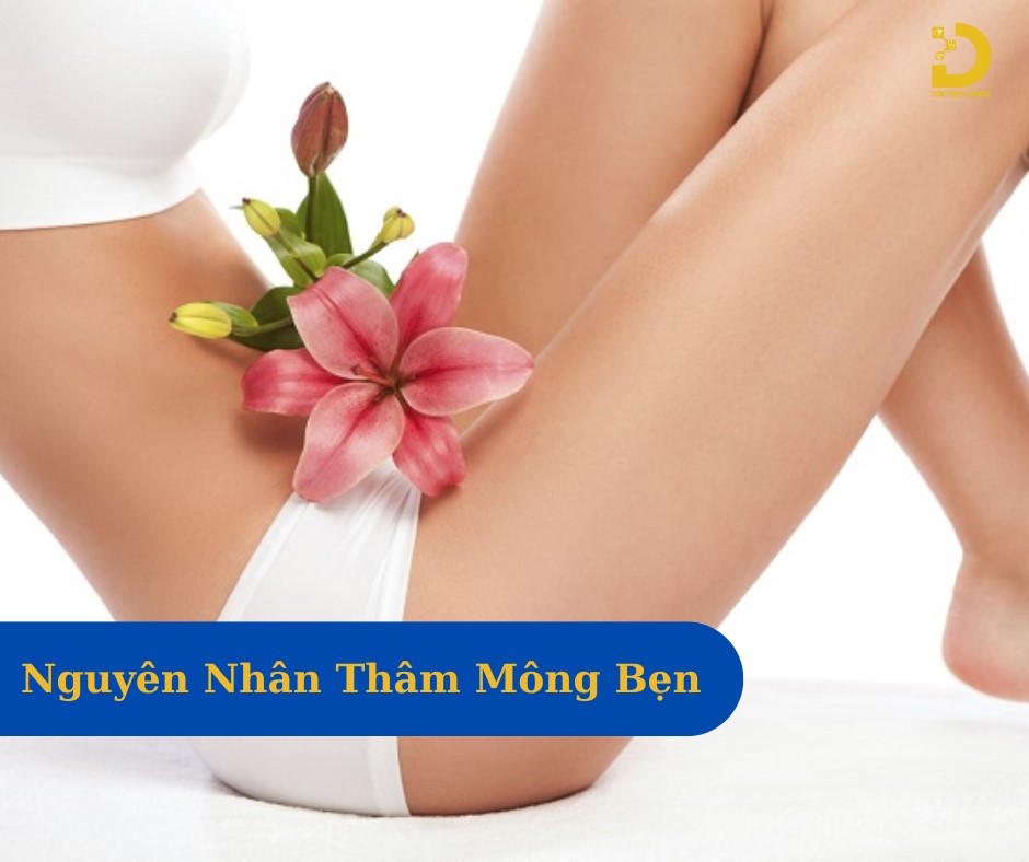 Thay đổi nội tiết tố, chưa vệ sinh cơ thể tốt, ma sát, chế độ sinh hoạt là nguyên nhân gây thâm vùng kín (mông, bẹn)