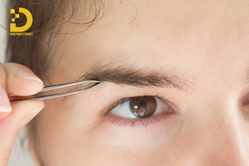 Nhổ lông mày là phương pháp loại bỏ lông mày tận gốc bằng nhíp.