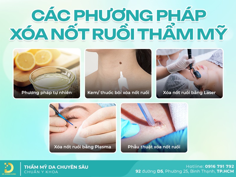 phuong phap xoa not ruoi tham my