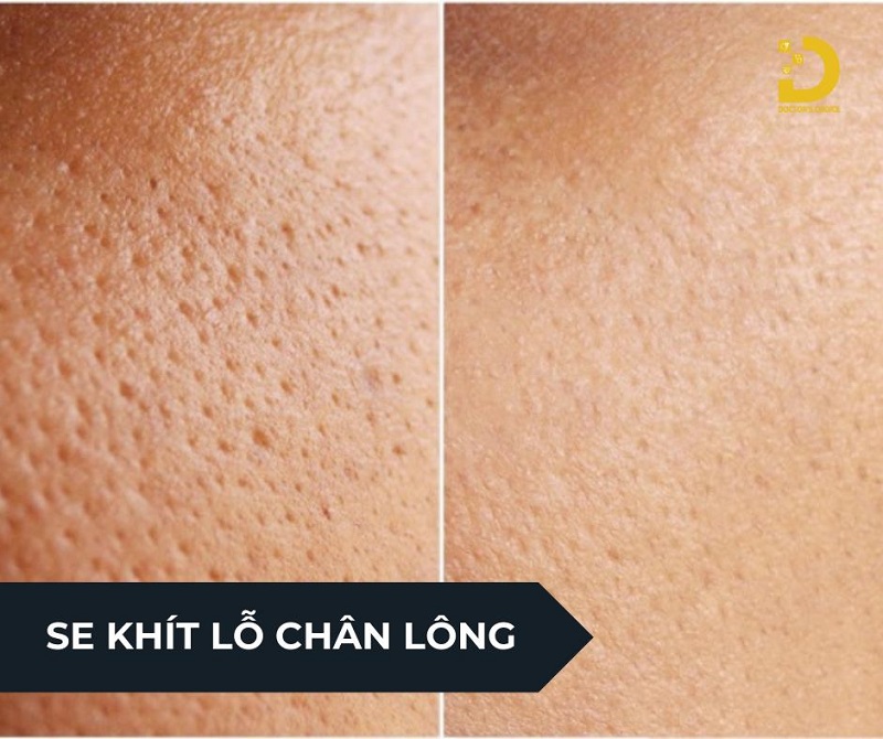 se khit lo chan long 3