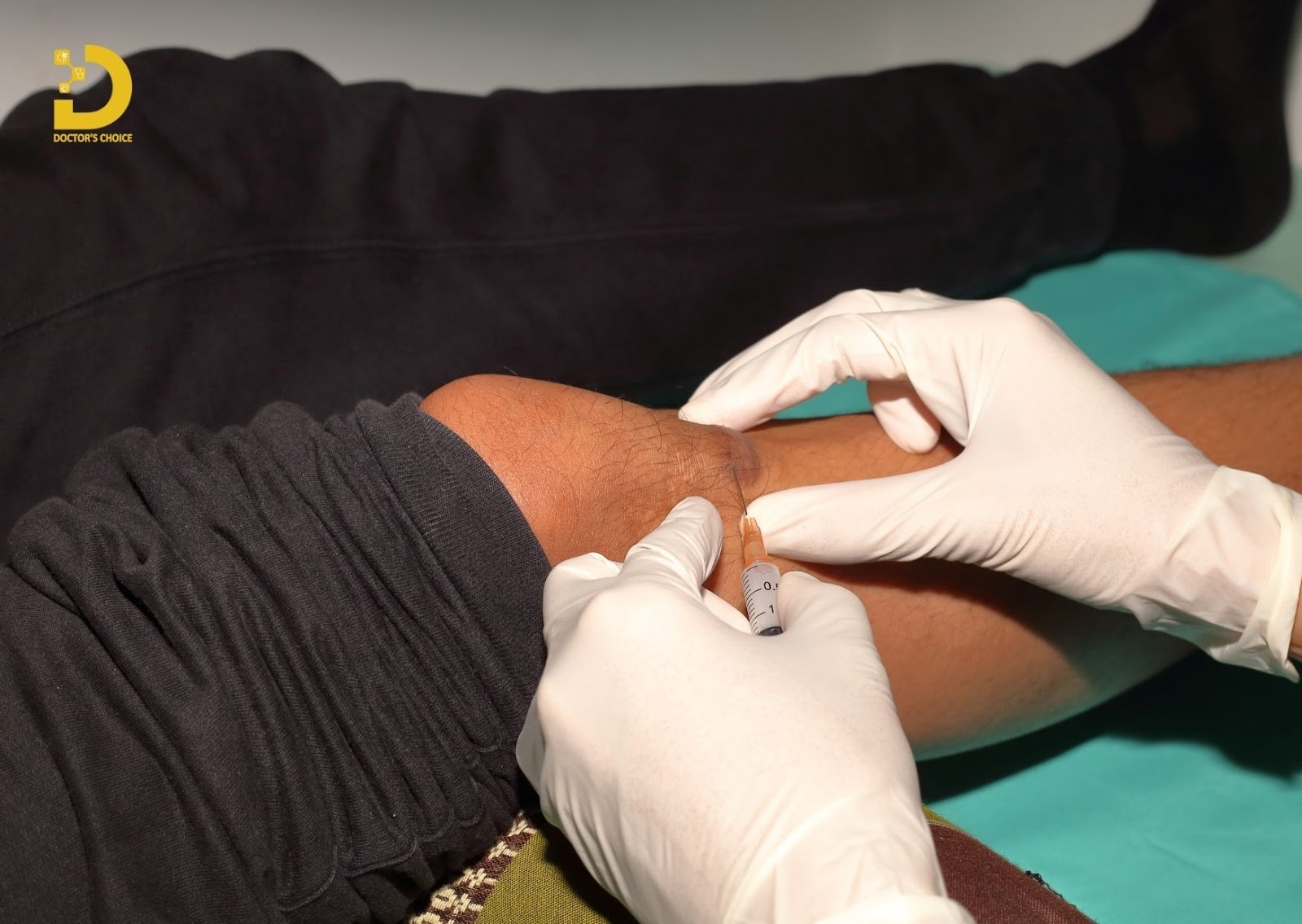 Tiêm là một phương pháp điều trị sẹo lồi hiệu quả