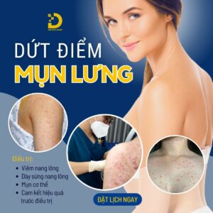 tri mun lung tan goc