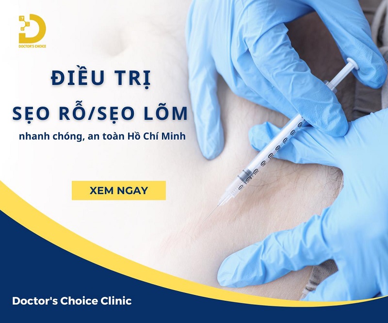 tri seo ro seo lom 1