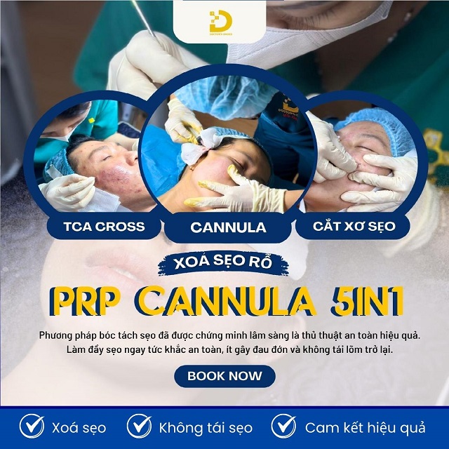 tri seo ro seo lom 10