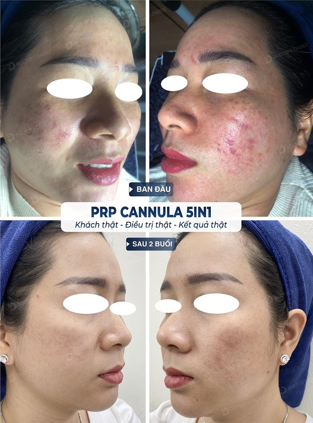 tri seo ro seo lom 14