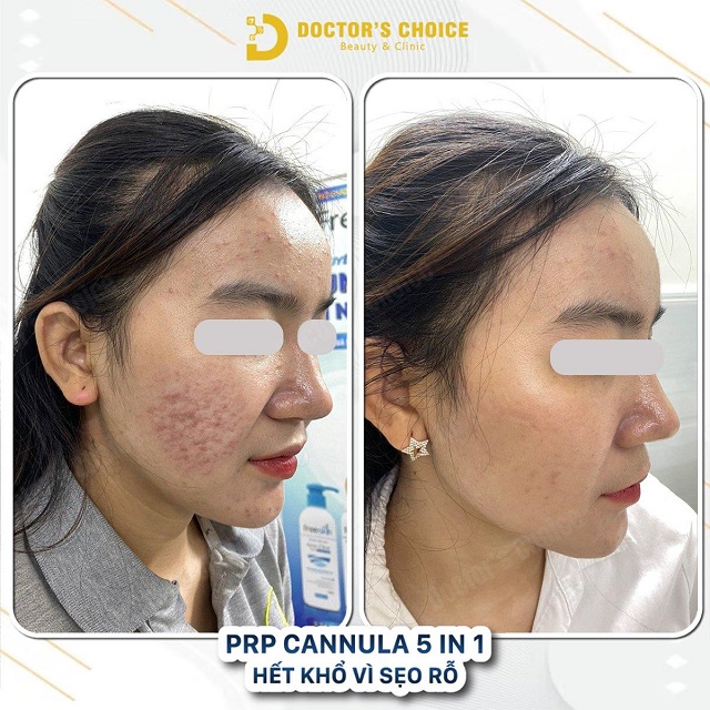 tri seo ro seo lom 18