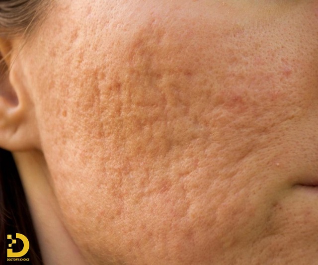 tri seo ro seo lom 5