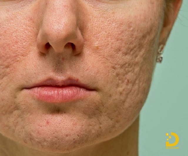 tri seo ro seo lom 6