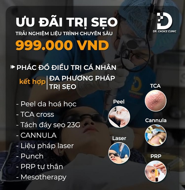 tri seo ro seo lom 9