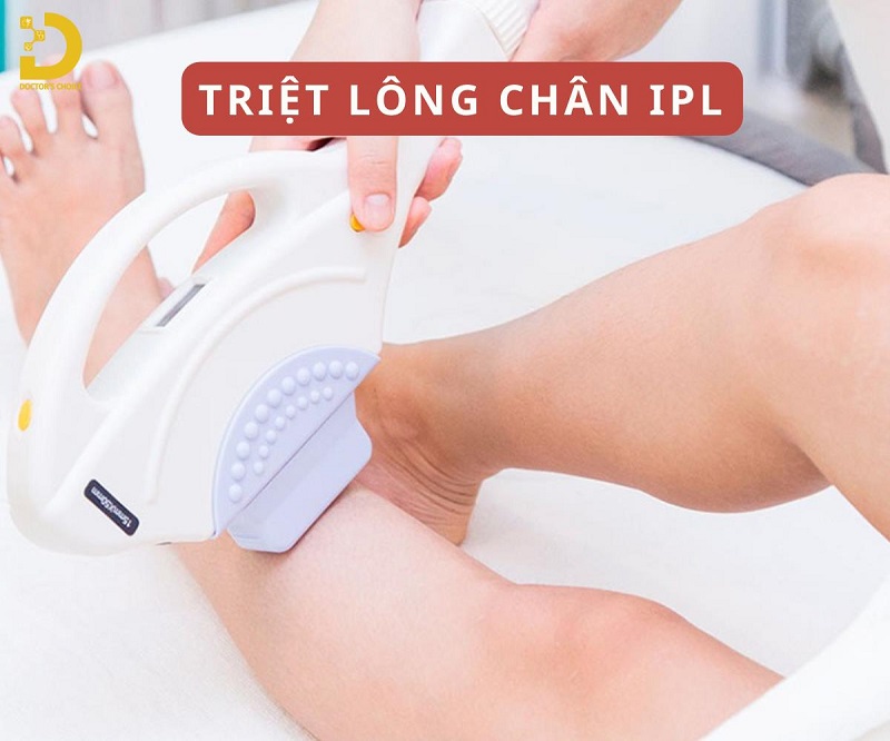 Dịch Vụ Triệt Lông Chân An Toàn Tận Gốc Tại HCM 9 triet long chan 3
