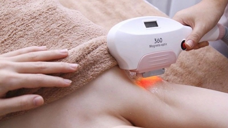 Triệt Lông Nách Tận Gốc Vĩnh Viễn, An Toàn HCM 12 Triệt lông nách công nghệ ánh sáng IPL
