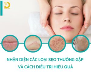 Các loại sẹo thường gặp và cách điều trị phù hợp