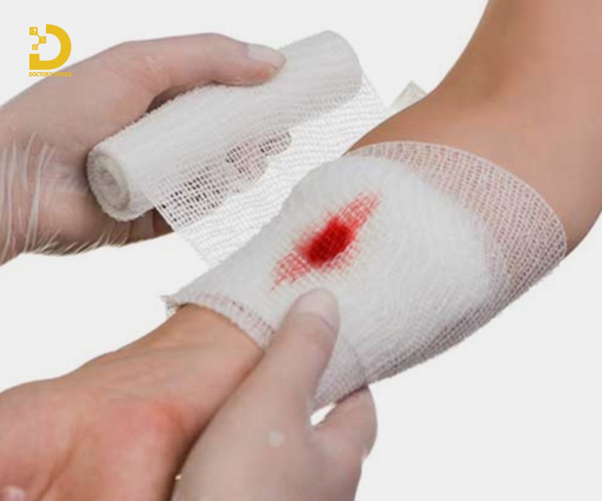 Băng bó vết thương không để lại sẹo