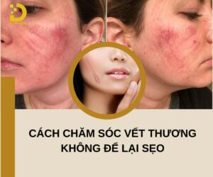 Cách chăm sóc vết thương không để lại sẹo