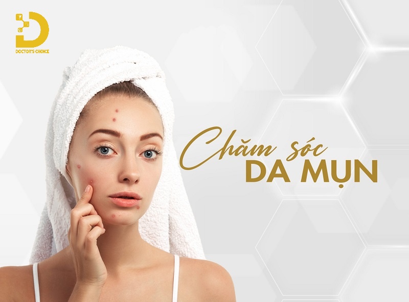 Chăm sóc da mụn đầu đen đúng cách