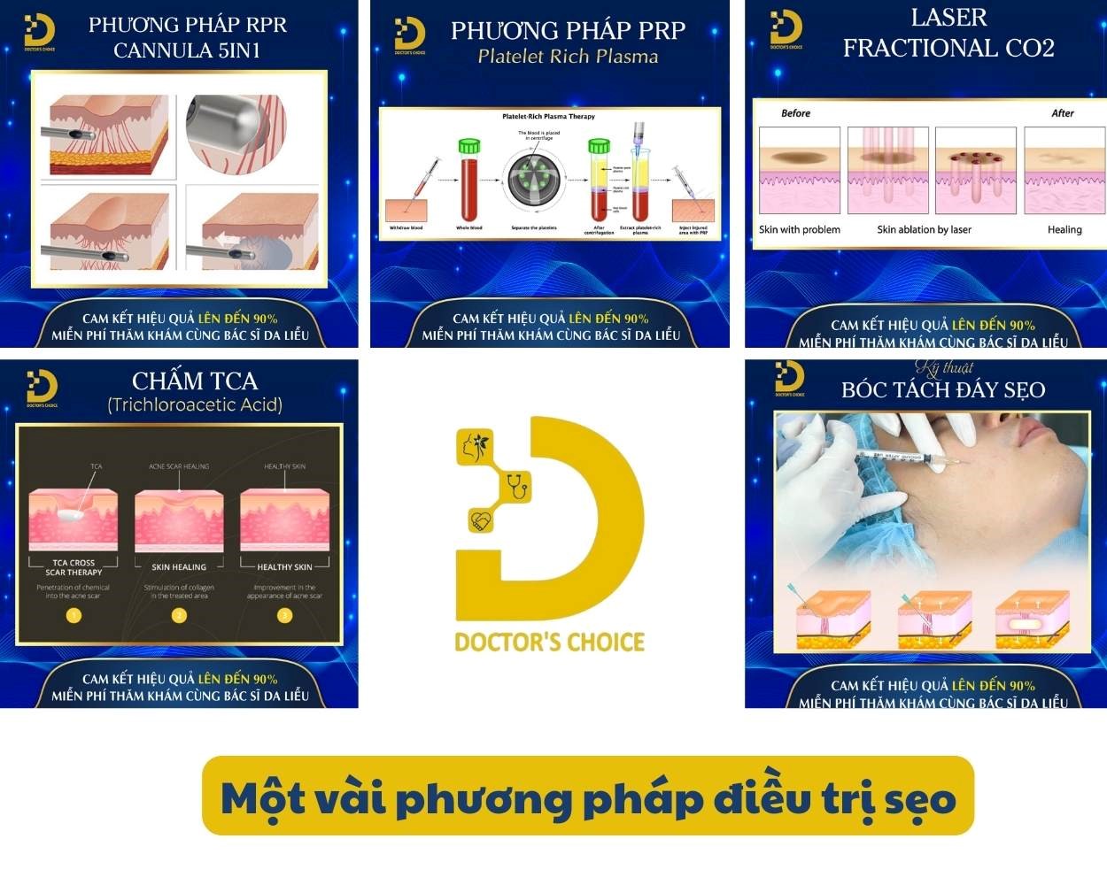 Các phương pháp điều trị sẹo phổ biến nhất hiện nay