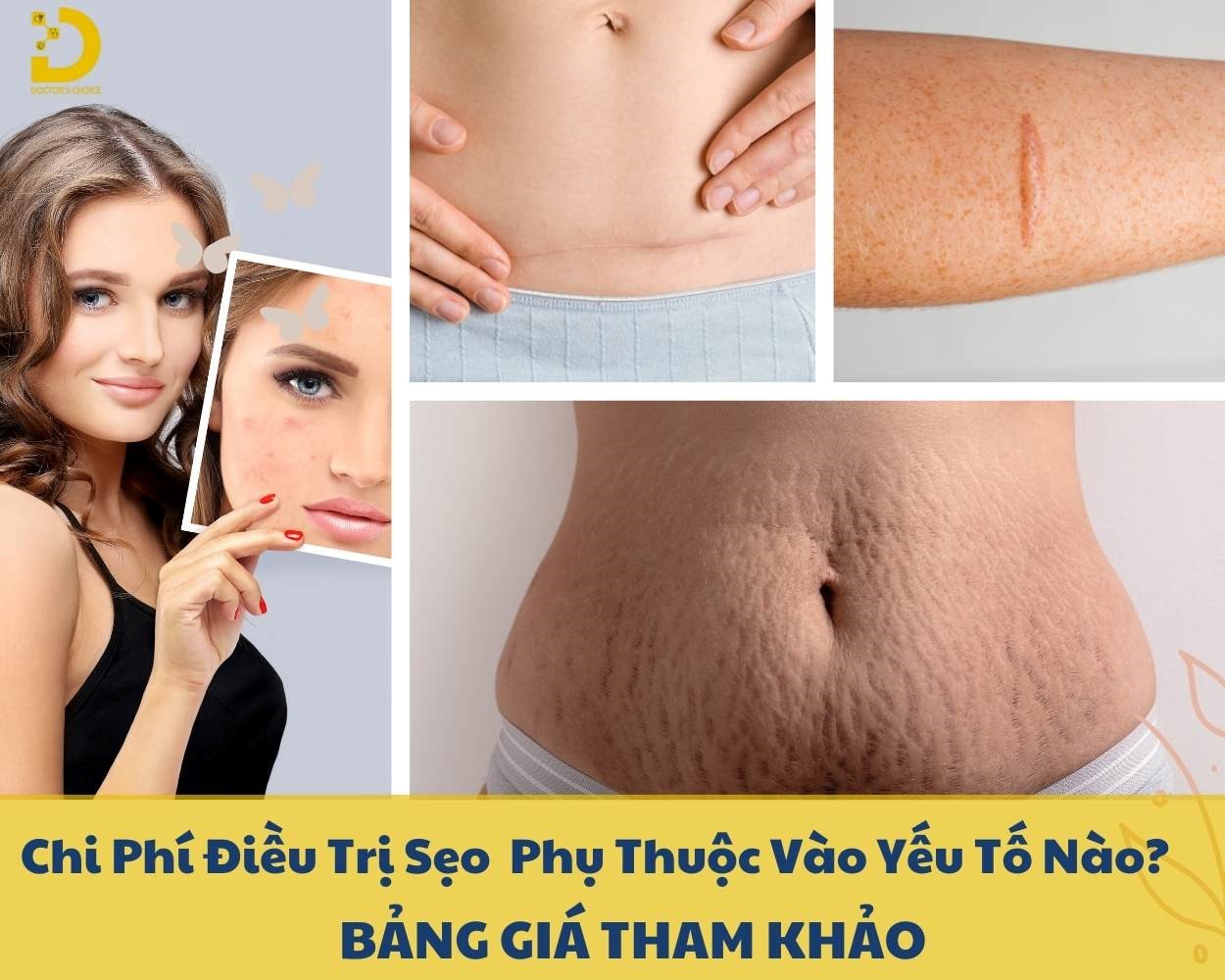 Các yếu tố ảnh hưởng đến chi phí điều trị sẹo