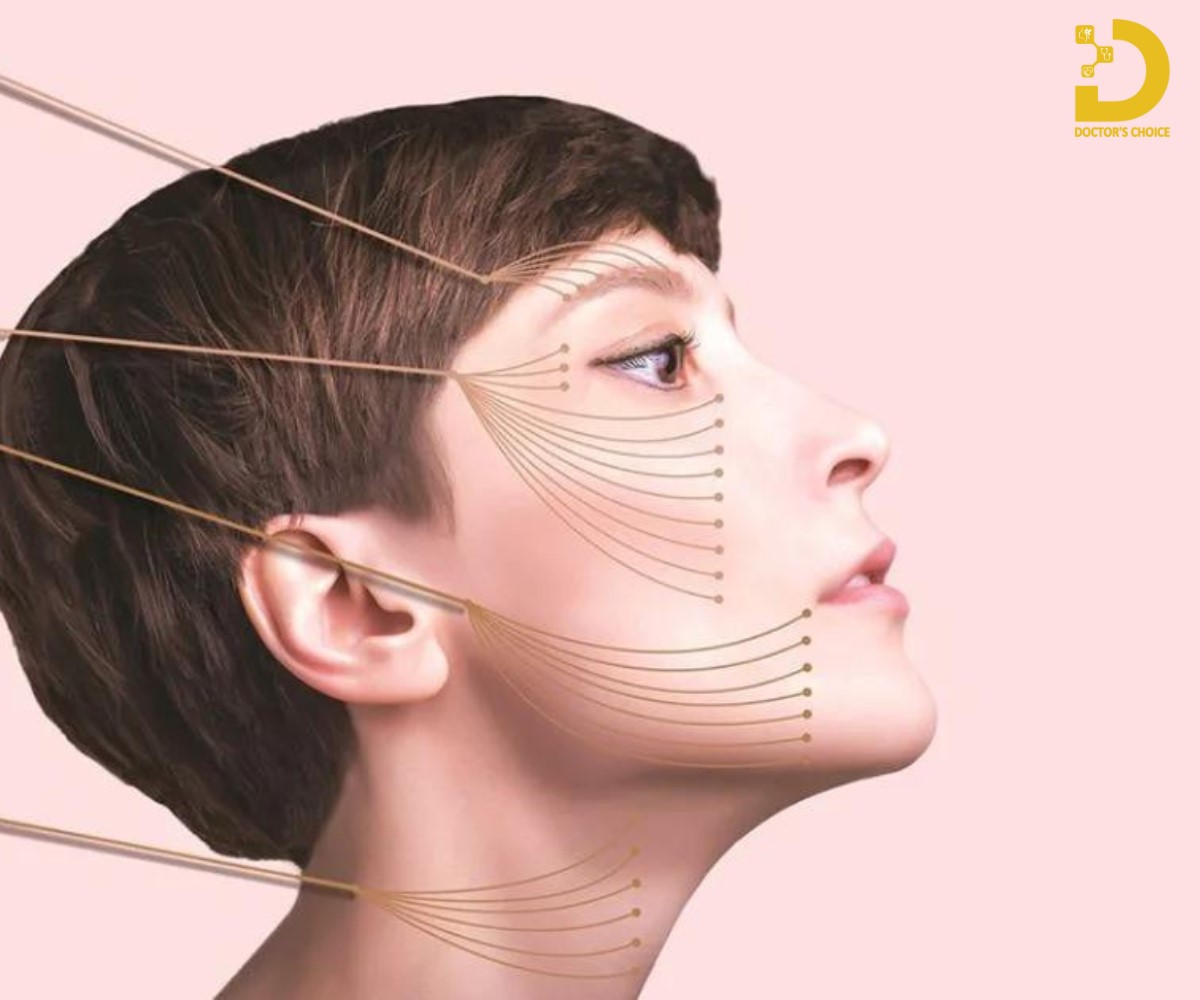 Căng chỉ trẻ hóa da mặt là một phương pháp thẩm mỹ không xâm lấn