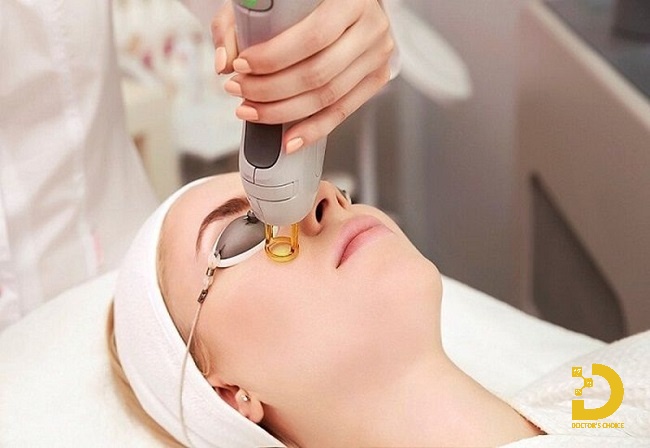 Phương pháp trị mụn đầu đinh bằng laser