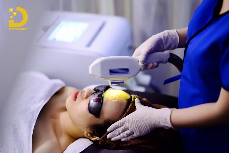 Điều trị mụn bằng laser
