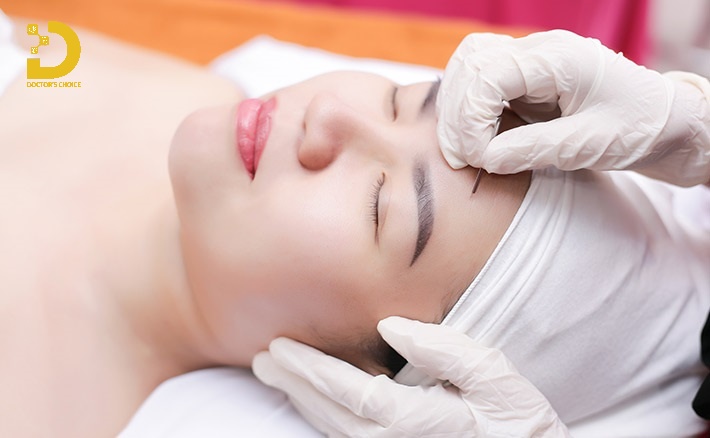 Lấy nhân mụn chuẩn y khoa