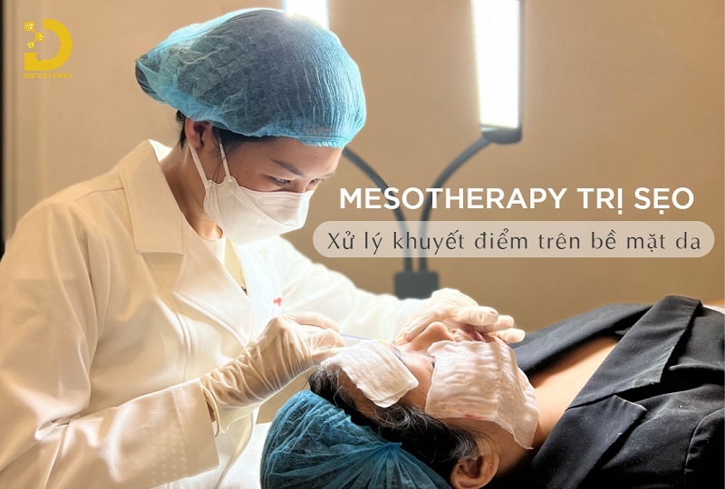 Điều trị sọe giãn bằng phương pháp Mesotherapy