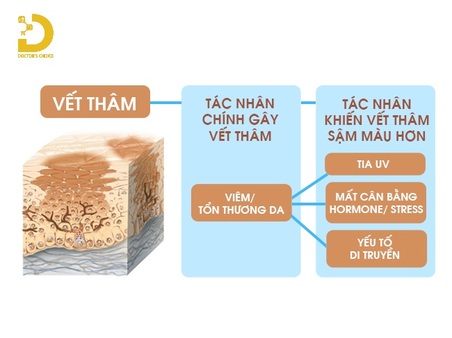 Nguyên nhân gây ra tình trạng da thâm