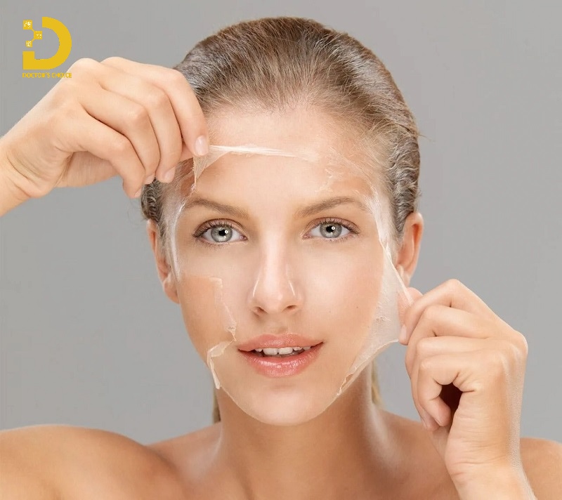 Peel da điều trị thâm mụn