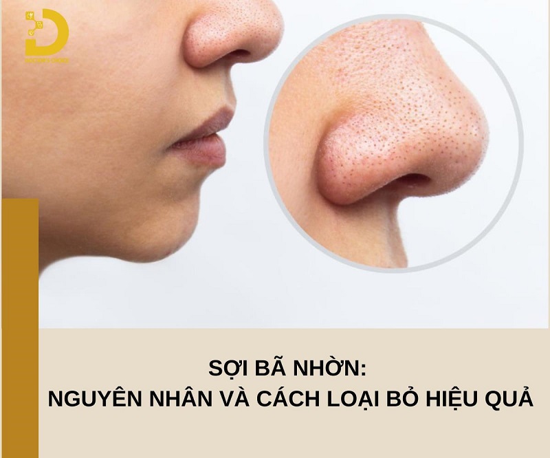 Sợi bã nhờn