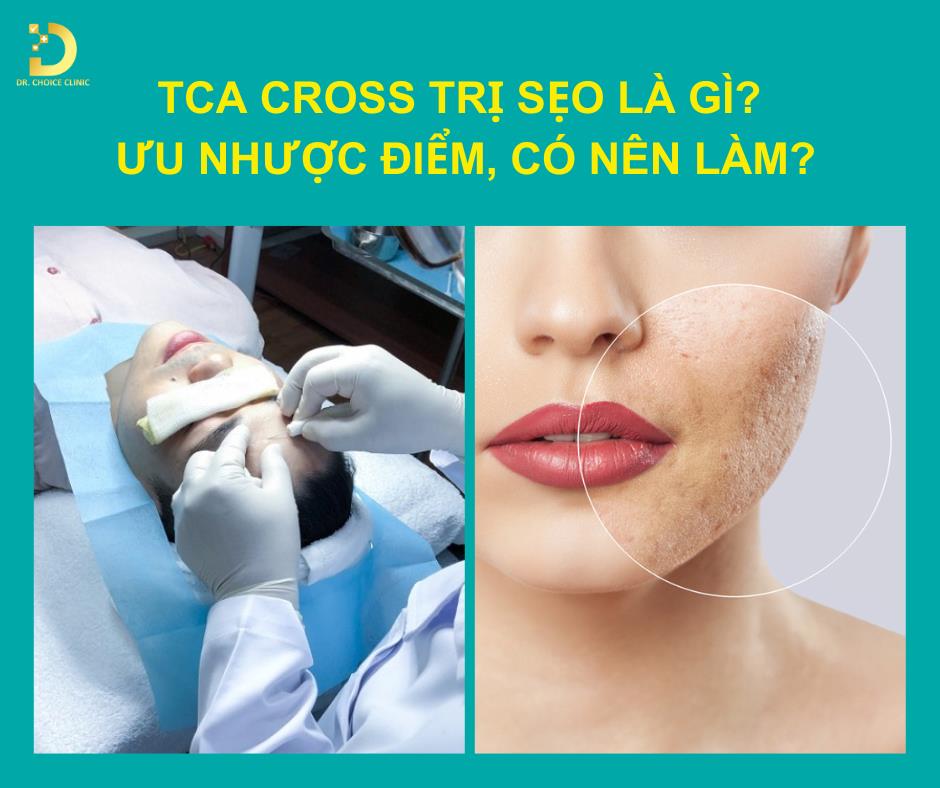 TCA Cross trị sẹo