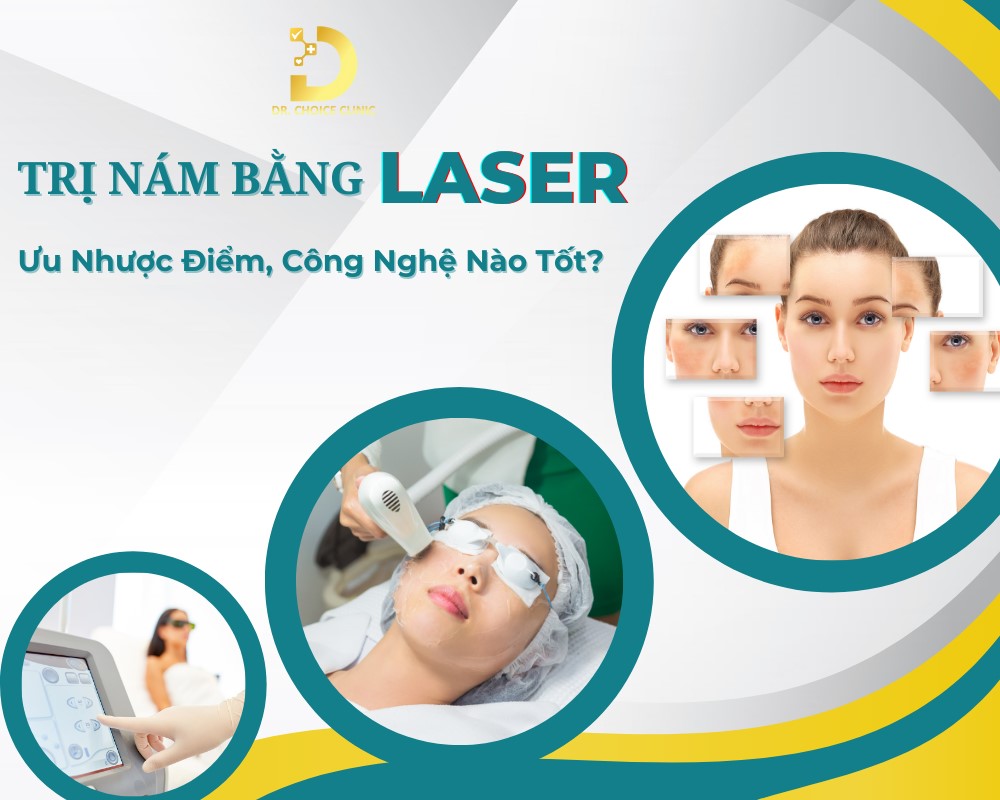 Trị nám da bằng laser