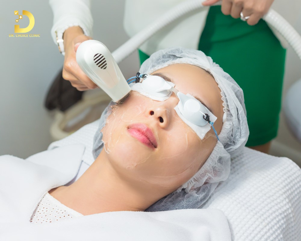 Trị nám da bằng laser
