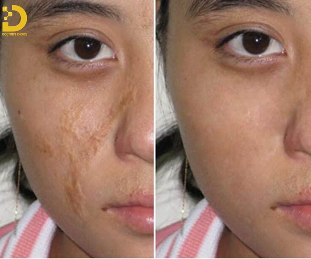 tri seo chuan y khoa 12