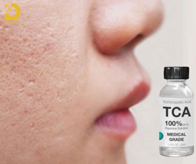 tri seo chuan y khoa 5