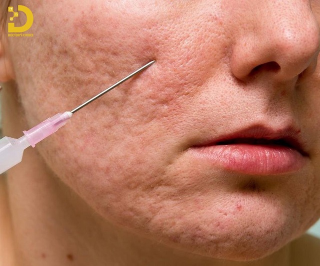 tri seo chuan y khoa 7