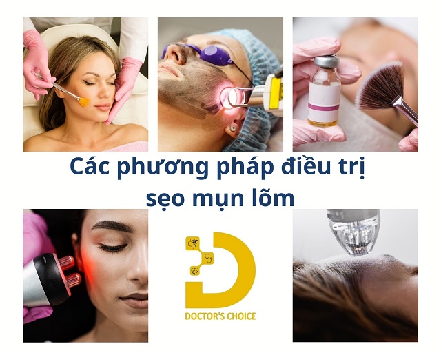 tri seo do mun trung ca 4